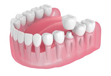 Image2
